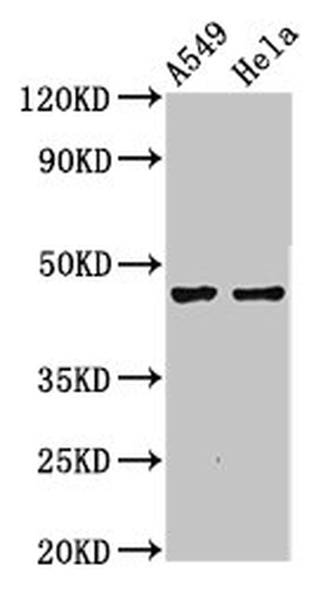 NMBR Antibody in Western Blot (WB)