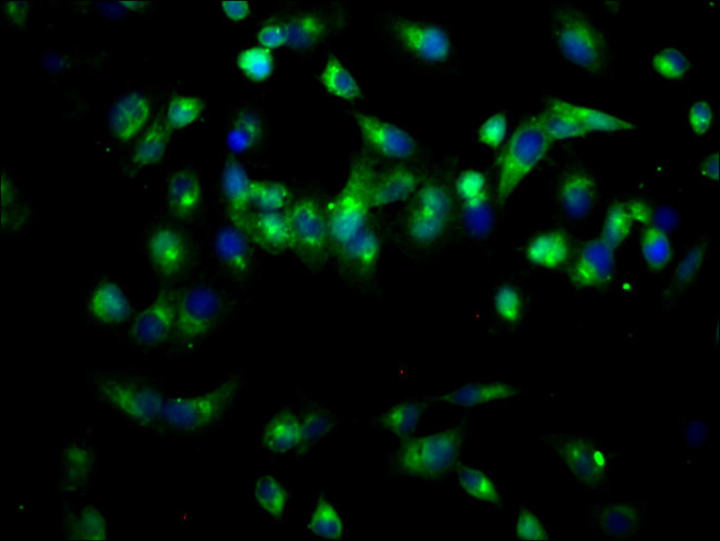 PAM Antibody in Immunocytochemistry (ICC/IF)