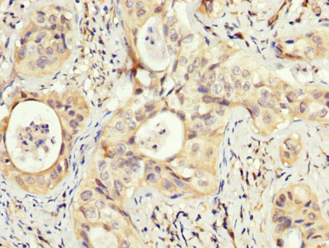 PEX5 Antibody in Immunohistochemistry (Paraffin) (IHC (P))