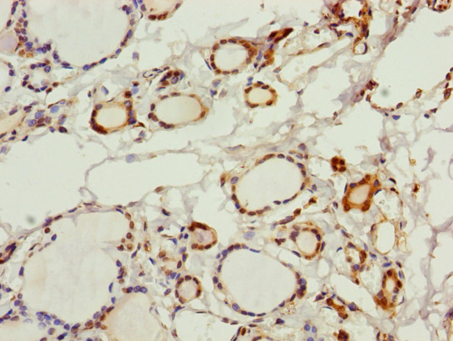 PGLS Antibody in Immunohistochemistry (Paraffin) (IHC (P))