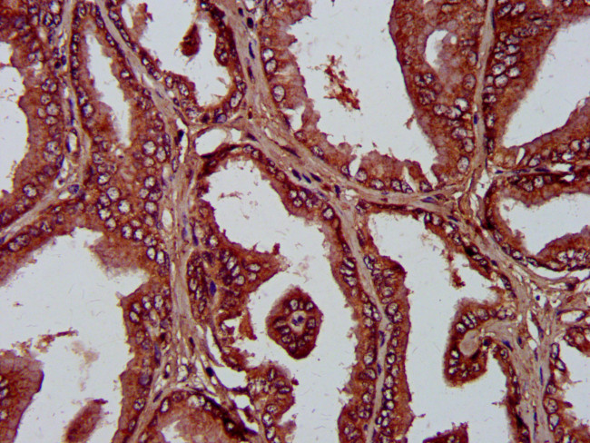 PLA1A Antibody in Immunohistochemistry (Paraffin) (IHC (P))