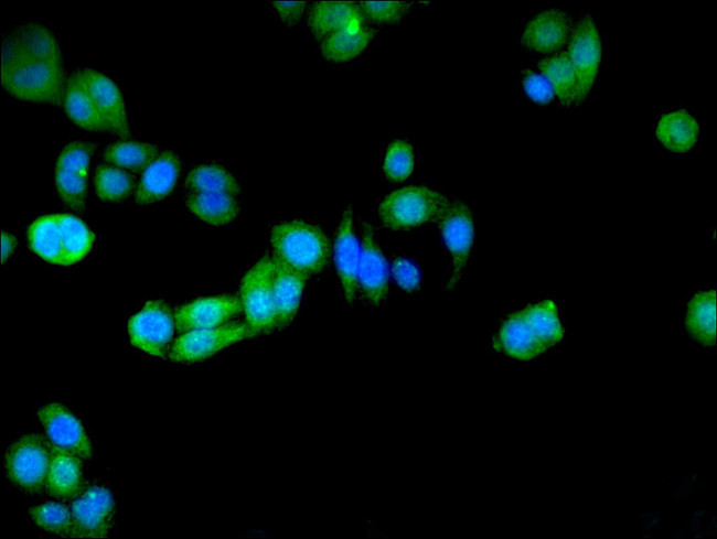 PRDX5 Antibody in Immunocytochemistry (ICC/IF)