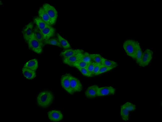 SLC26A4 Antibody in Immunocytochemistry (ICC/IF)