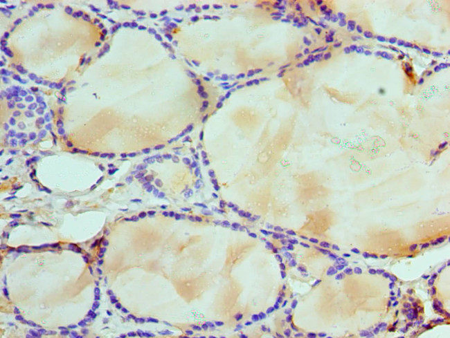 WDR5 Antibody in Immunohistochemistry (Paraffin) (IHC (P))