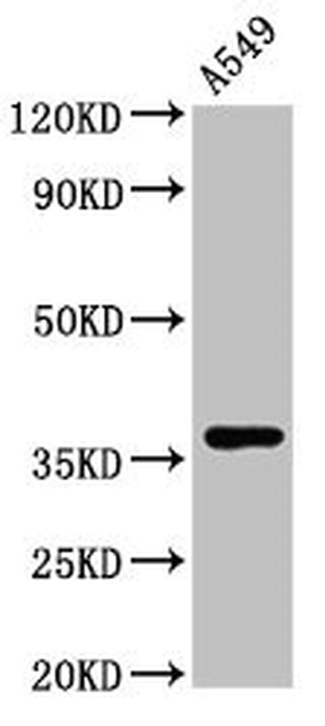 ZNF488 Antibody in Western Blot (WB)