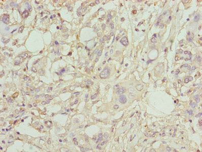 PLA2G7 Antibody in Immunohistochemistry (Paraffin) (IHC (P))