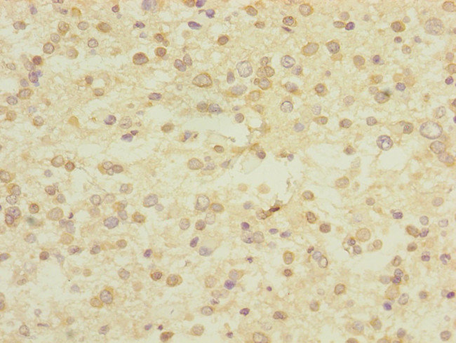 UBE4A Antibody in Immunohistochemistry (Paraffin) (IHC (P))