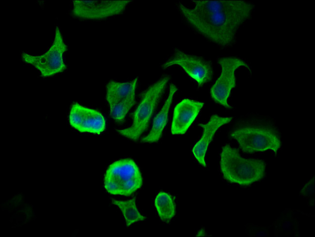 CCDC6 Antibody in Immunocytochemistry (ICC/IF)