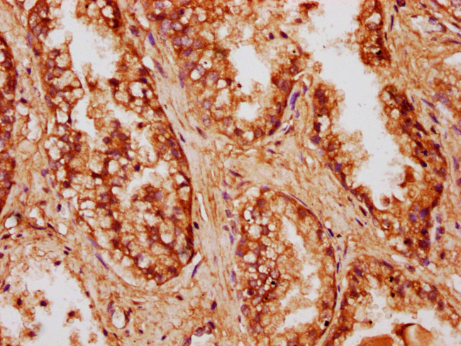 CCDC6 Antibody in Immunohistochemistry (Paraffin) (IHC (P))