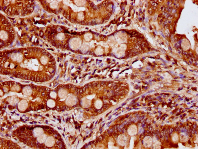 CCDC6 Antibody in Immunohistochemistry (Paraffin) (IHC (P))