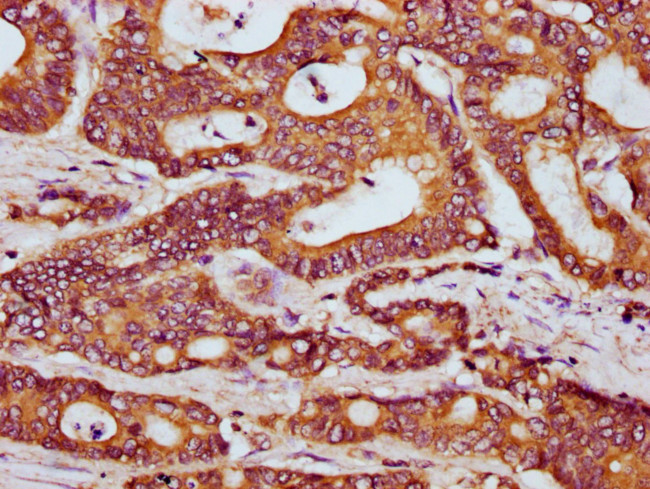 HOOK3 Antibody in Immunohistochemistry (Paraffin) (IHC (P))