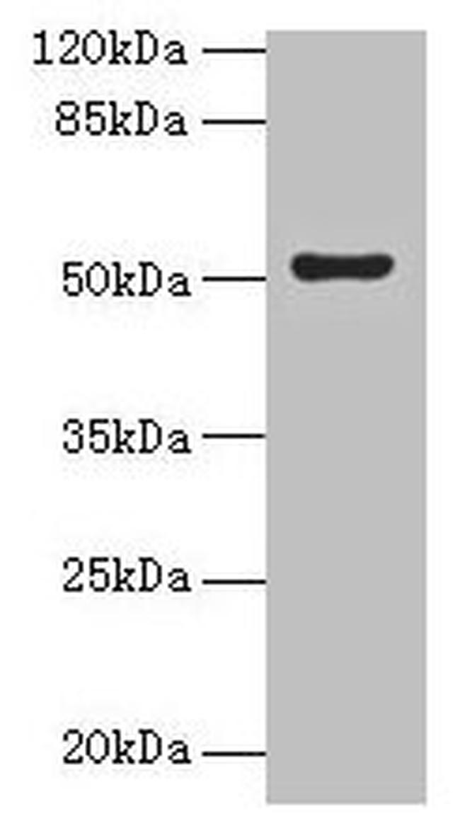 SLC46A3 Antibody in Western Blot (WB)