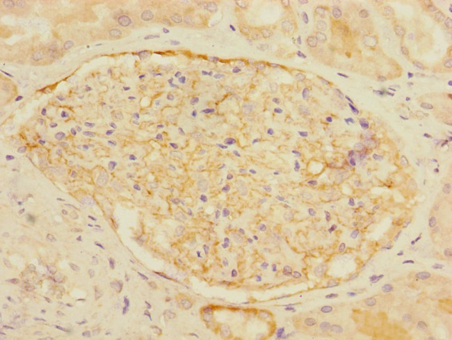 CD35 Antibody in Immunohistochemistry (Paraffin) (IHC (P))