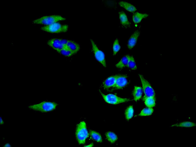 SLC20A1 Antibody in Immunocytochemistry (ICC/IF)