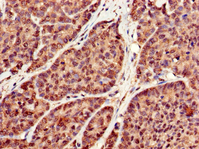 RBFA Antibody in Immunohistochemistry (Paraffin) (IHC (P))