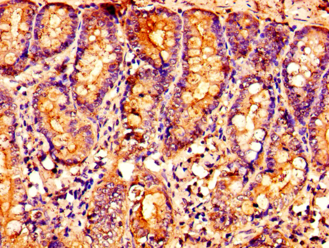 OXER1 Antibody in Immunohistochemistry (Paraffin) (IHC (P))