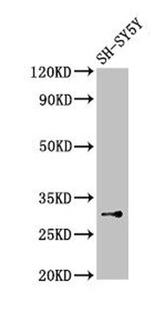 ISOC1 Antibody in Western Blot (WB)