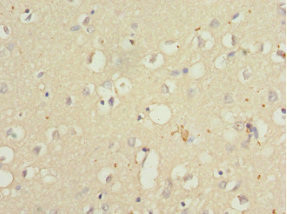 QKI Antibody in Immunohistochemistry (Paraffin) (IHC (P))