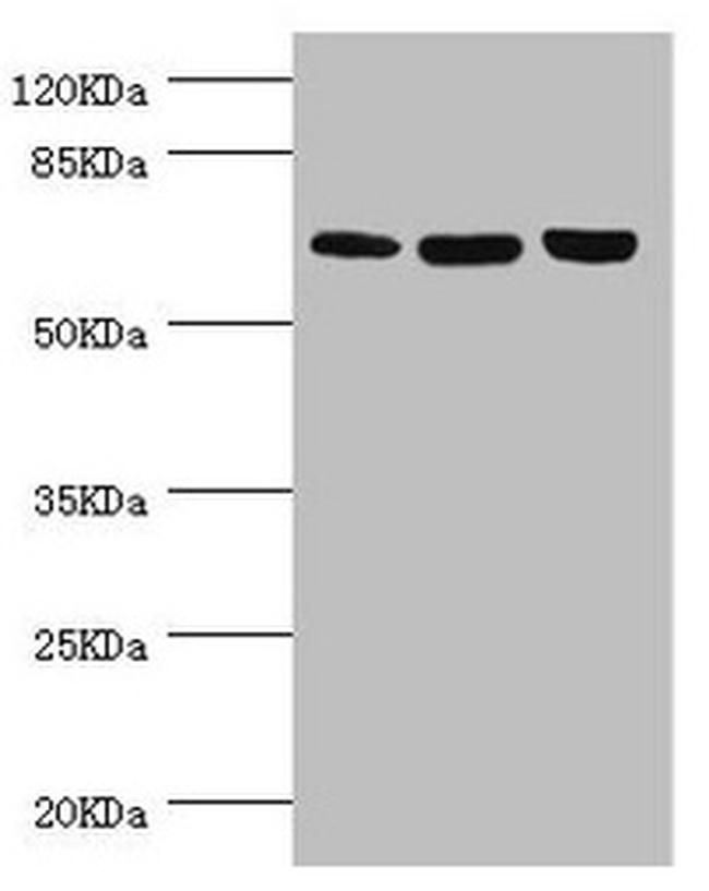 CTNNBL1 Antibody in Western Blot (WB)