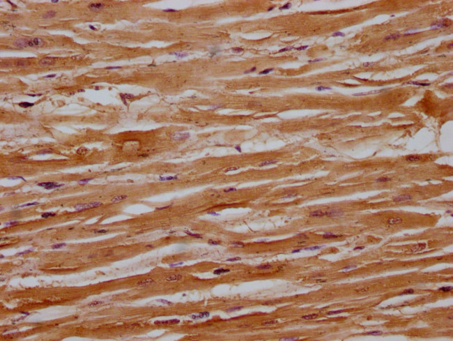 RANBP9 Antibody in Immunohistochemistry (Paraffin) (IHC (P))