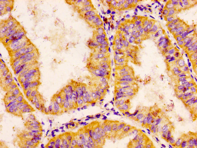 CHRDL1 Antibody in Immunohistochemistry (Paraffin) (IHC (P))