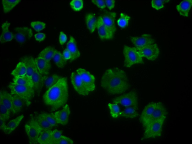 SLC19A3 Antibody in Immunocytochemistry (ICC/IF)