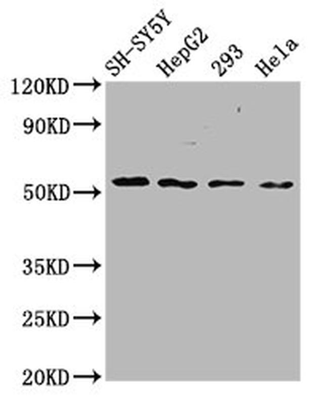 SLC19A3 Antibody in Western Blot (WB)