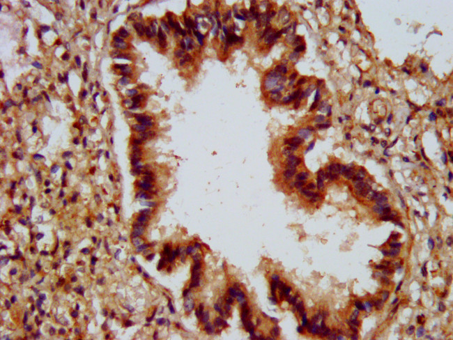 ALG9 Antibody in Immunohistochemistry (Paraffin) (IHC (P))