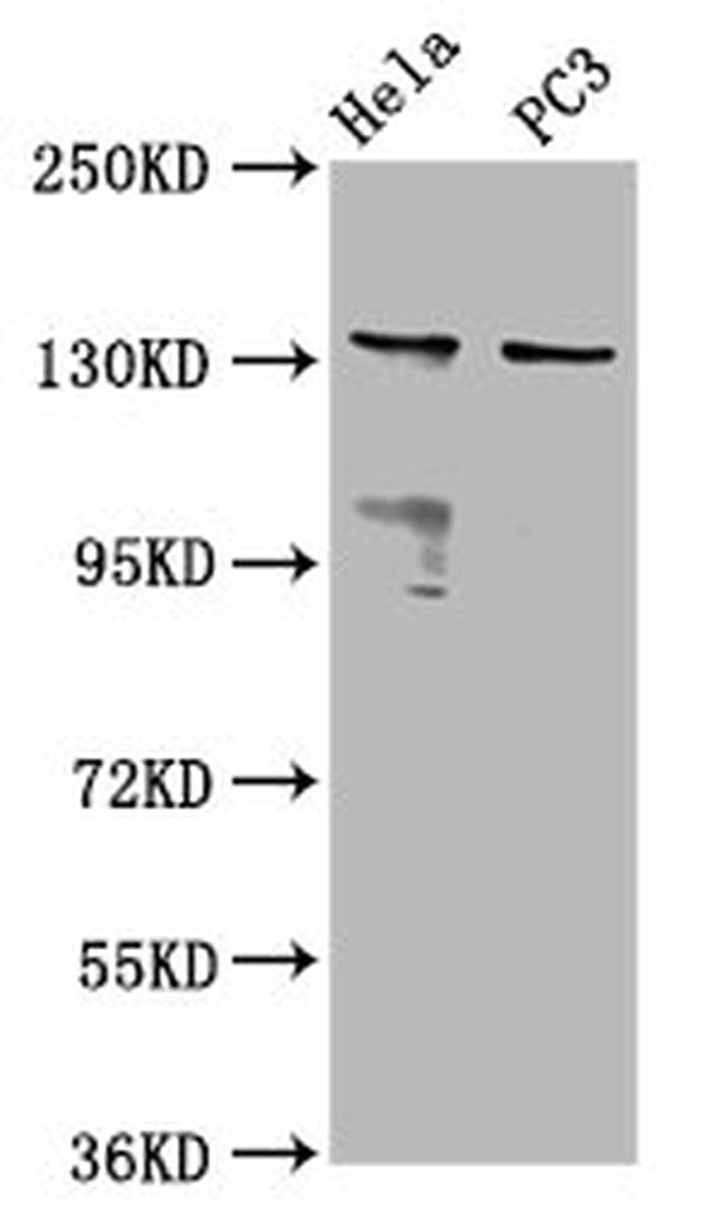 MOV10L1 Antibody in Western Blot (WB)