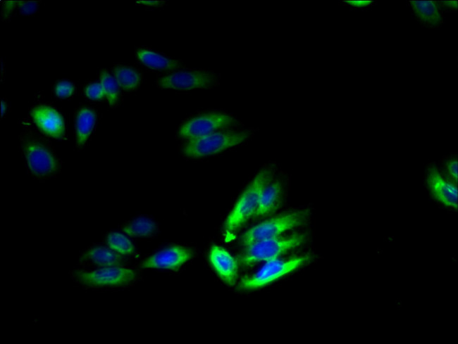 TSCOT Antibody in Immunocytochemistry (ICC/IF)