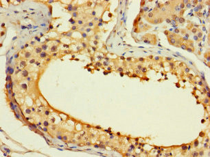 ASF1B Antibody in Immunohistochemistry (Paraffin) (IHC (P))