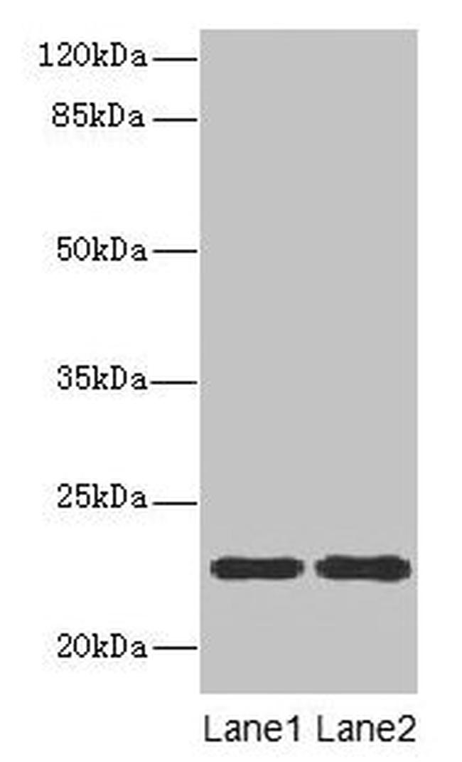 ASF1B Antibody in Western Blot (WB)