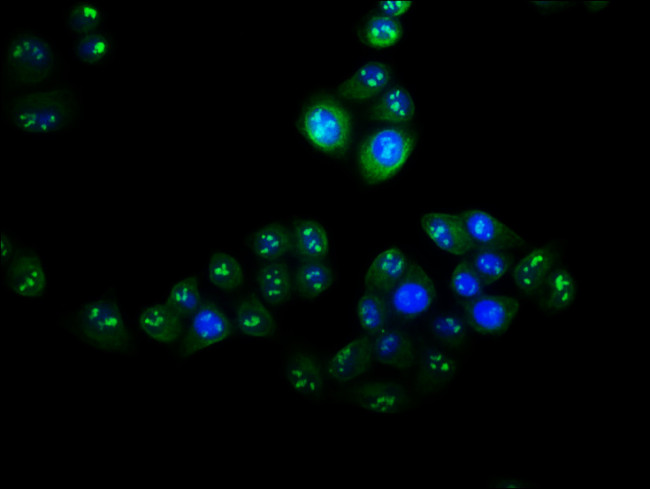 VPS25 Antibody in Immunocytochemistry (ICC/IF)