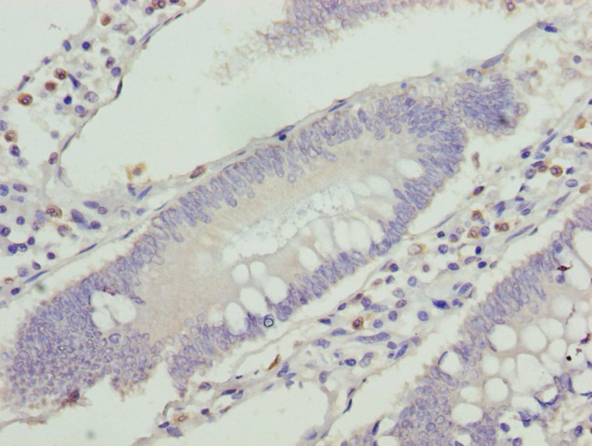 VPS25 Antibody in Immunohistochemistry (Paraffin) (IHC (P))