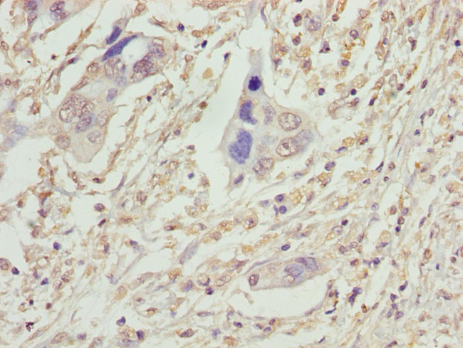 VPS25 Antibody in Immunohistochemistry (Paraffin) (IHC (P))