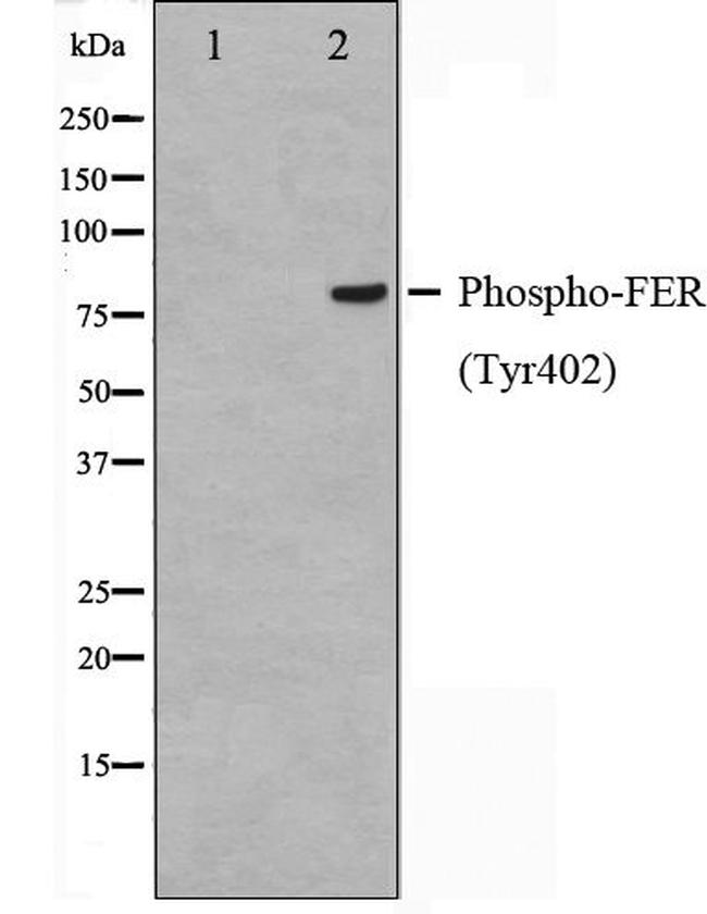 Phospho-FER (Tyr402) Antibody in Western Blot (WB)