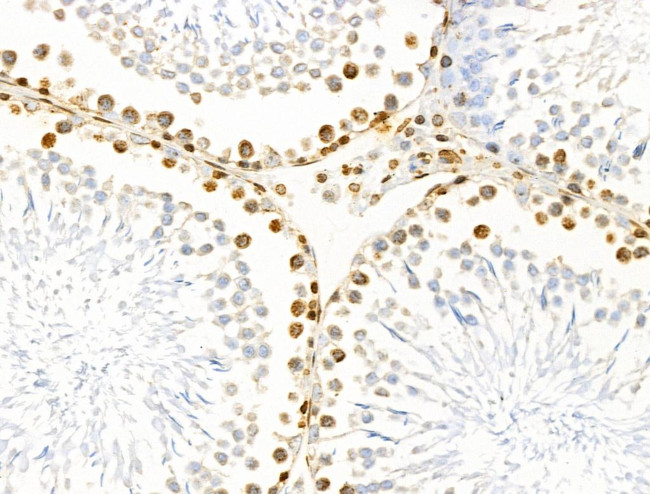 E2F4 Antibody in Immunohistochemistry (Paraffin) (IHC (P))