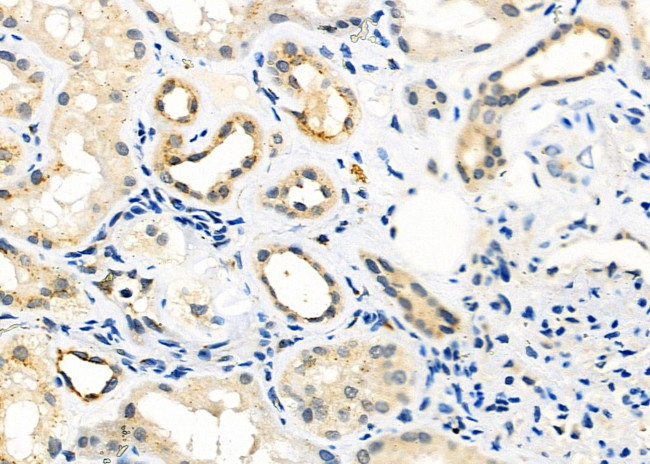 FGFR1OP Antibody in Immunohistochemistry (Paraffin) (IHC (P))