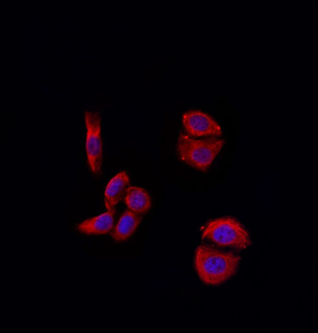 MMP11 Antibody in Immunocytochemistry (ICC/IF)