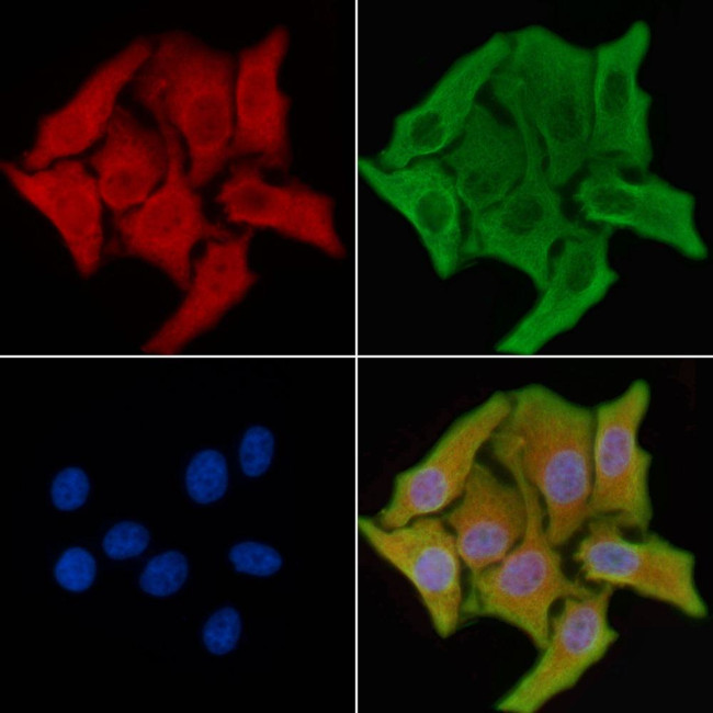 ADPGK Antibody in Immunocytochemistry (ICC/IF)