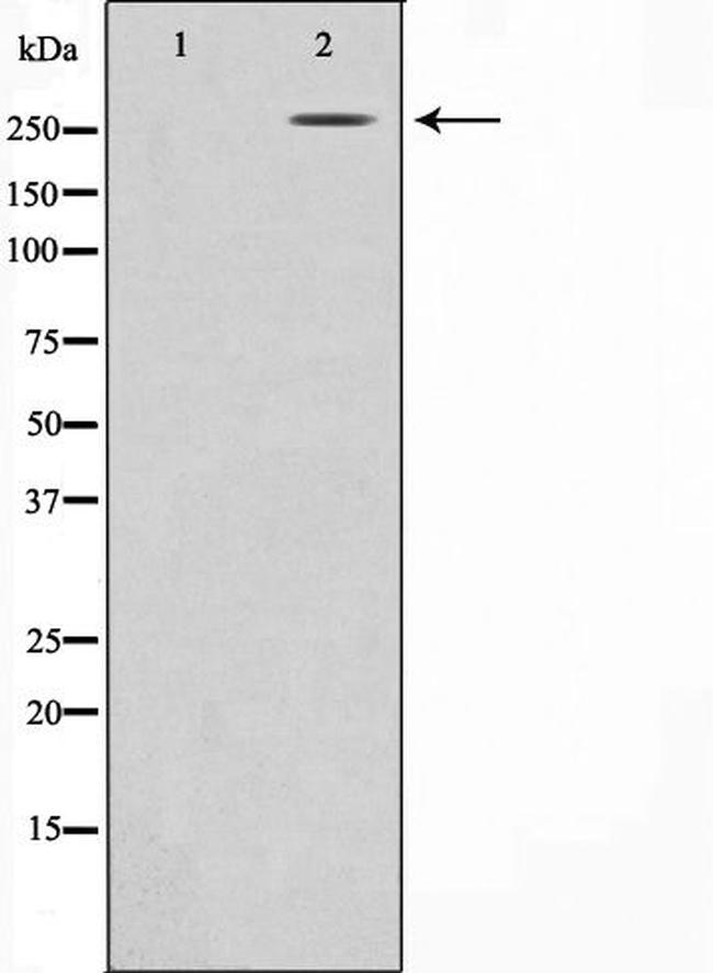 Fibronectin Antibody in Western Blot (WB)