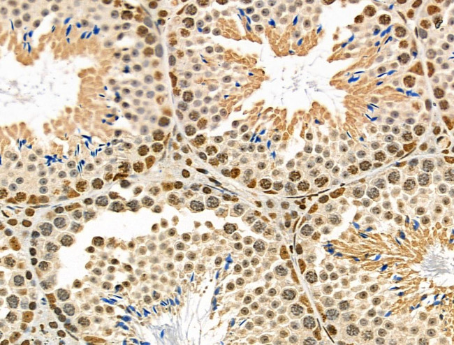 Phospho-CtBP1 (Ser422) Antibody in Immunohistochemistry (Paraffin) (IHC (P))