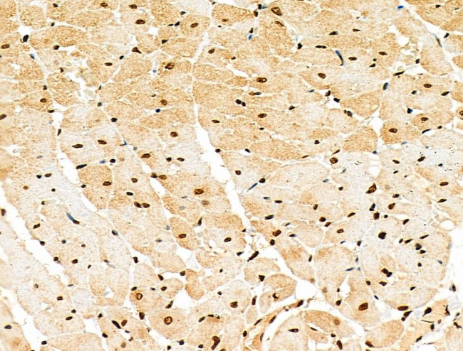 Phospho-CtBP1 (Ser422) Antibody in Immunohistochemistry (Paraffin) (IHC (P))