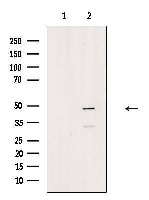 Phospho-CtBP1 (Ser422) Antibody in Western Blot (WB)