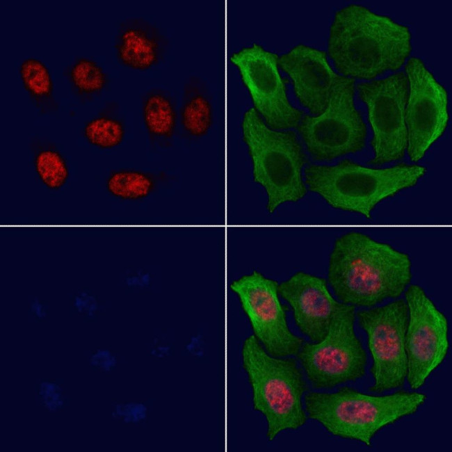 H3K23ac Antibody in Immunocytochemistry (ICC/IF)