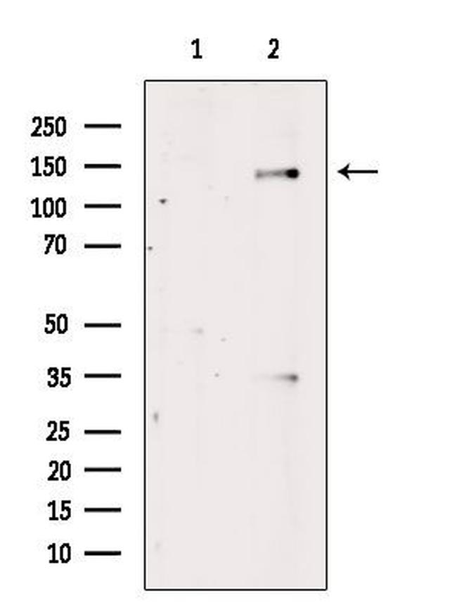 Phospho-ABL1/ABL2 (Tyr393) Antibody in Western Blot (WB)
