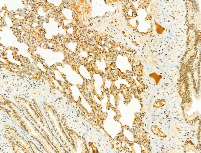 Phospho-SREBP1 (Ser439) Antibody in Immunohistochemistry (Paraffin) (IHC (P))