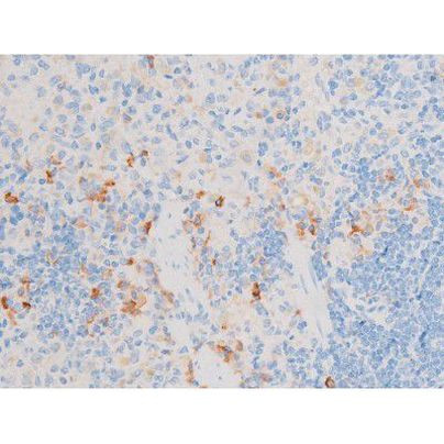 Phospho-SMAD2/SMAD3 (Thr8) Antibody in Immunohistochemistry (Paraffin) (IHC (P))