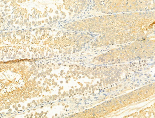 Phospho-SMAD2/SMAD3 (Thr8) Antibody in Immunohistochemistry (Paraffin) (IHC (P))