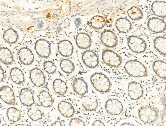 Phospho-SMAD2/SMAD3 (Thr8) Antibody in Immunohistochemistry (Paraffin) (IHC (P))